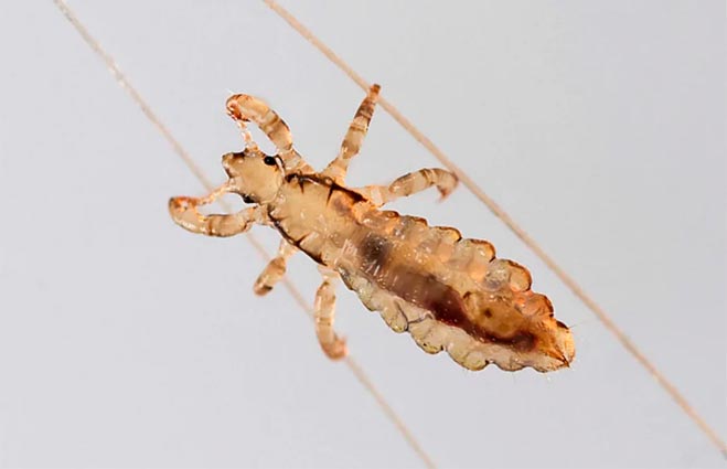 Why Don’t Over the Counter Lice Removal Products Work